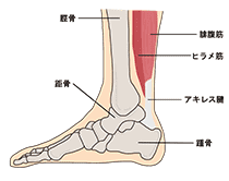 アキレス腱はどこにあるのか？