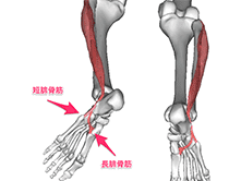 腓骨筋腱炎の痛みとは