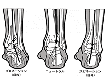 プロネーション障害とは