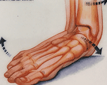 足関節のプロネーション障害の原因