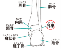 捻挫