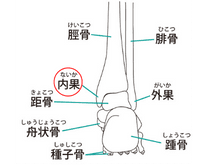 足関節の脛骨内果骨折