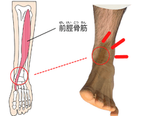 足首の不都合な動き