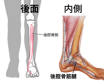 後脛骨筋腱機能不全