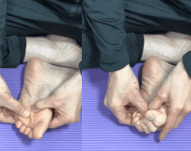 中足骨骨頭痛のマッサージと足指運動法