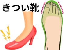 きついと感じている靴を我慢して履き続けていた|さいたま中央フットケア整体院