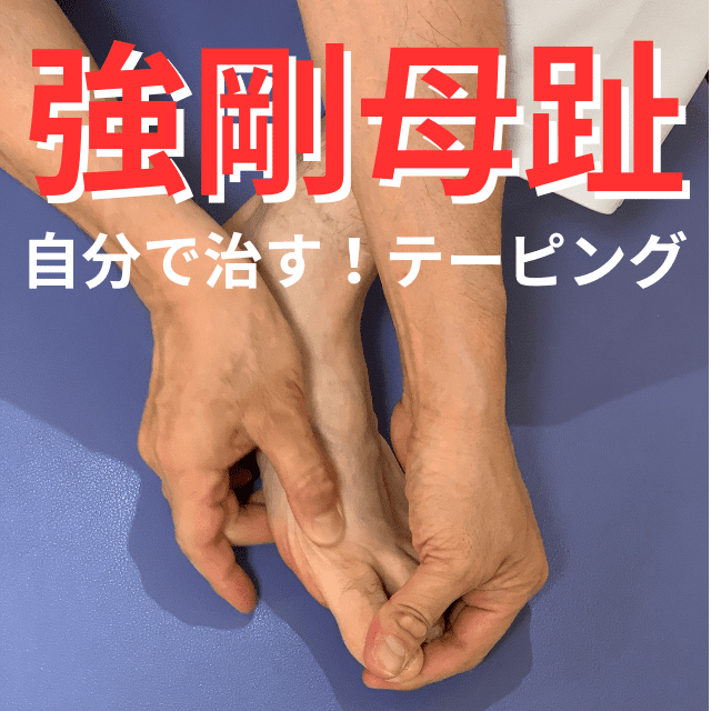 強剛母趾のテーピングで【即日に痛みが改善】した症例をご紹介!|さいたま中央フットケア整体院