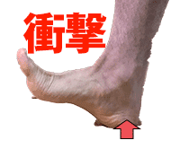 踵の奥が痛い、距骨下関節痛の原因