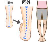 ハグルンド病の原因（ふくらはぎやハムストリングスの過緊張）