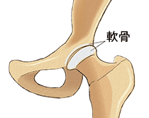 股関節の軟骨