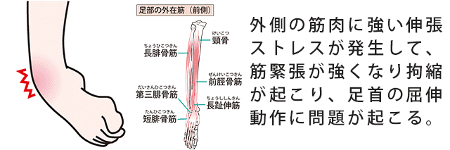 足首のメカニズム