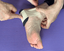 足裏の痛みのテーピングクッション法