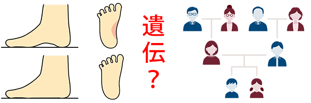 偏平足