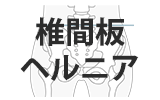 腰部椎間板ヘルニアの整体