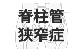 脊柱管狭窄症の整体