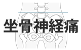 坐骨神経痛の整体