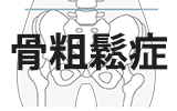 骨粗鬆症の腰痛の整体
