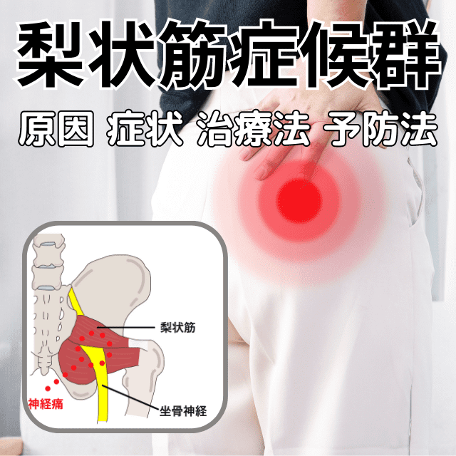 梨状筋症候群とは、原因と症状、治療と予防|さいたま中央フットケア整体院