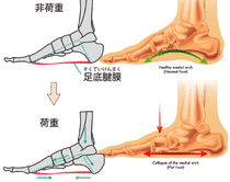 トラスト機構