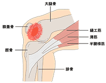 膝蓋大腿関節症とは