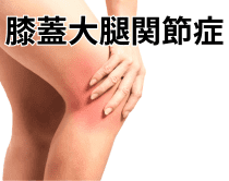 膝蓋大腿関節症