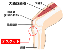 オスグッド・シュラッター病の原因