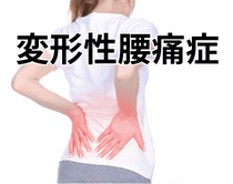 変形性腰痛症