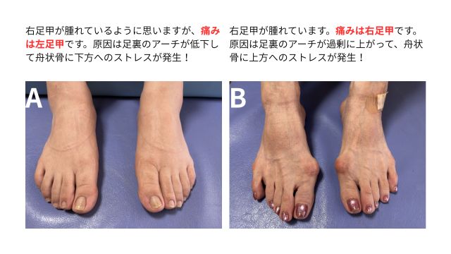 足裏のアーチから考えられること