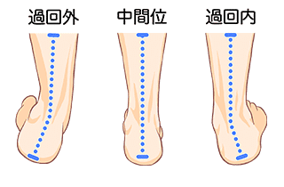 足首痛の原因は筋肉