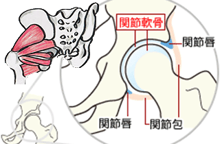 股関節の原因は筋肉