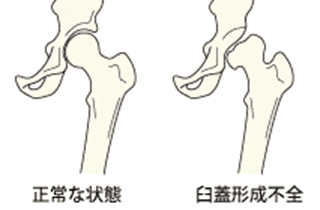 慢性痛