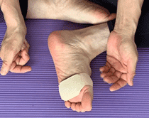 モートン病・足指付け根痛のクッション法