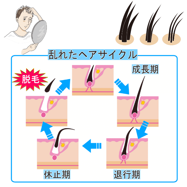 ヘアサイクルの乱れ|さいたま中央フットケア整体院