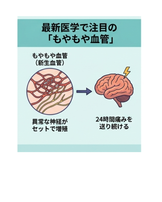 【決定版】なぜ長引く痛みは「好きなことをしている時」に消えるのか？脳の誤作動ともやもや血管のメカニズム