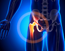 股関節（hip joint）
